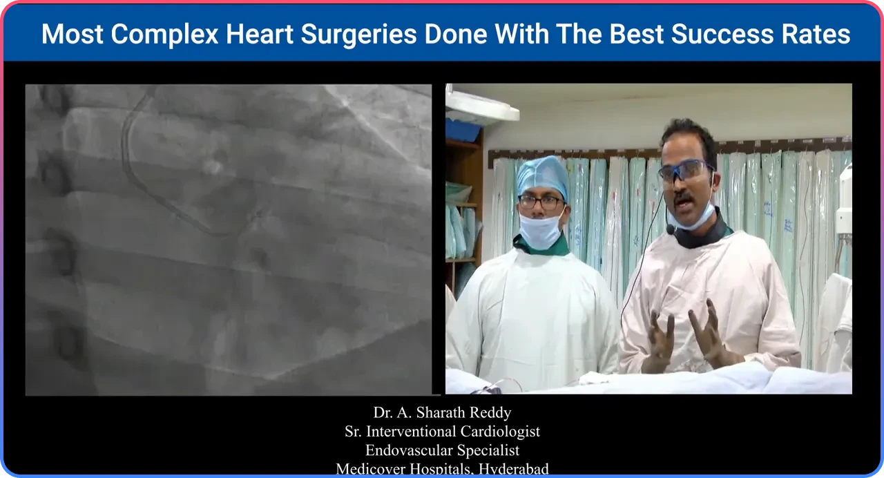 Anterior RCA Origin
