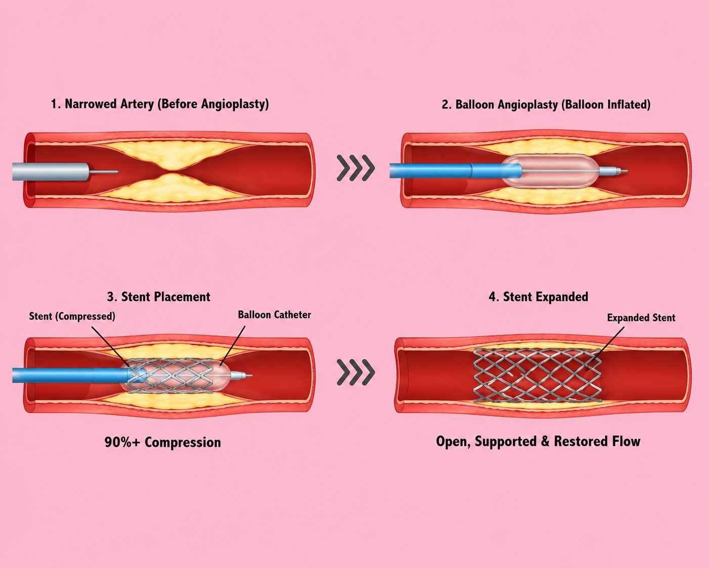 Decoding Complex PCI: Rota Through Guide Extension Explained