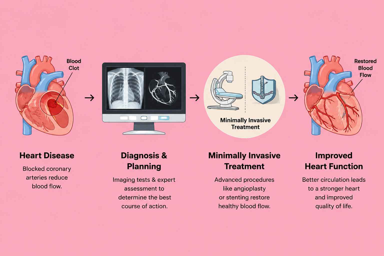 Heart Valve Surgeries: A New Era in Cardiac Care