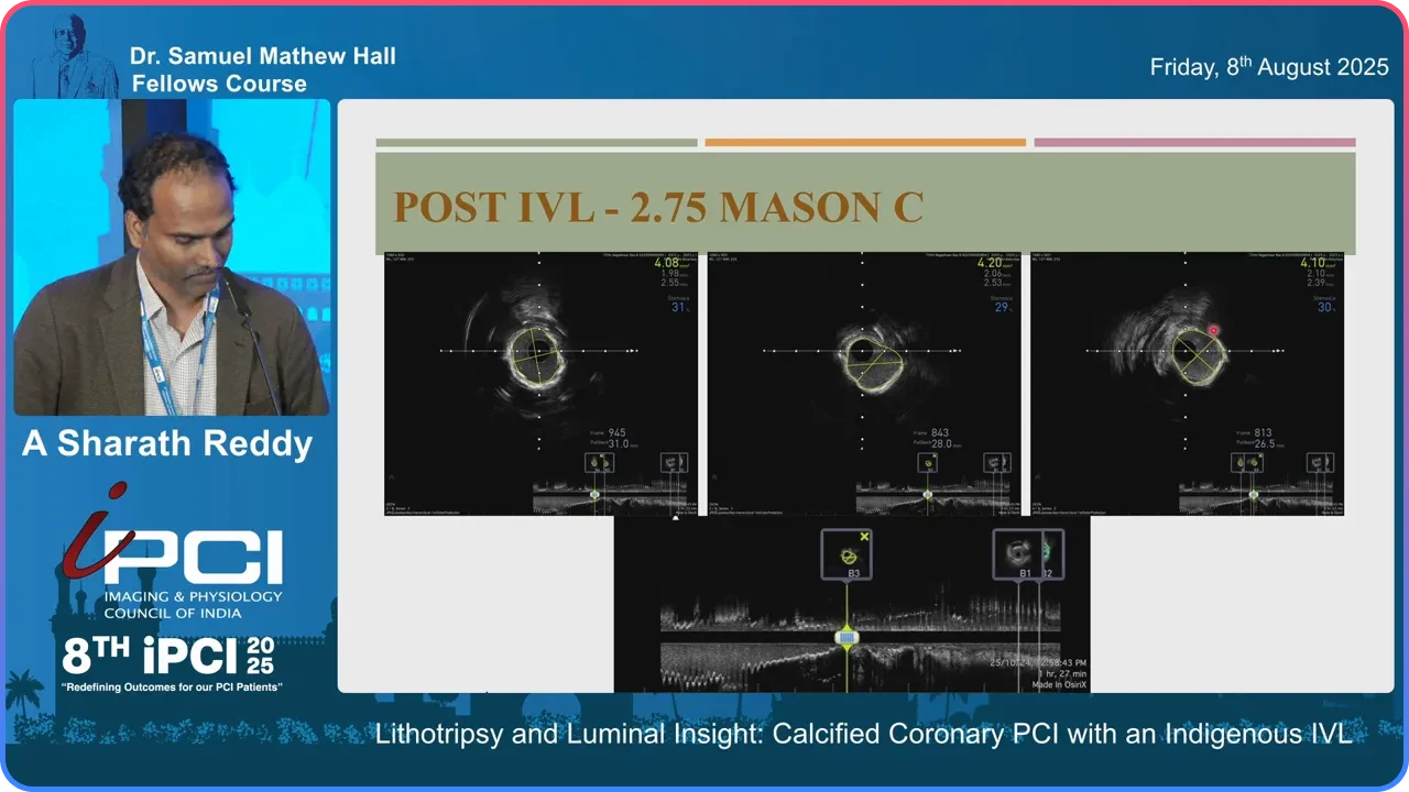 Case 1 IVUS