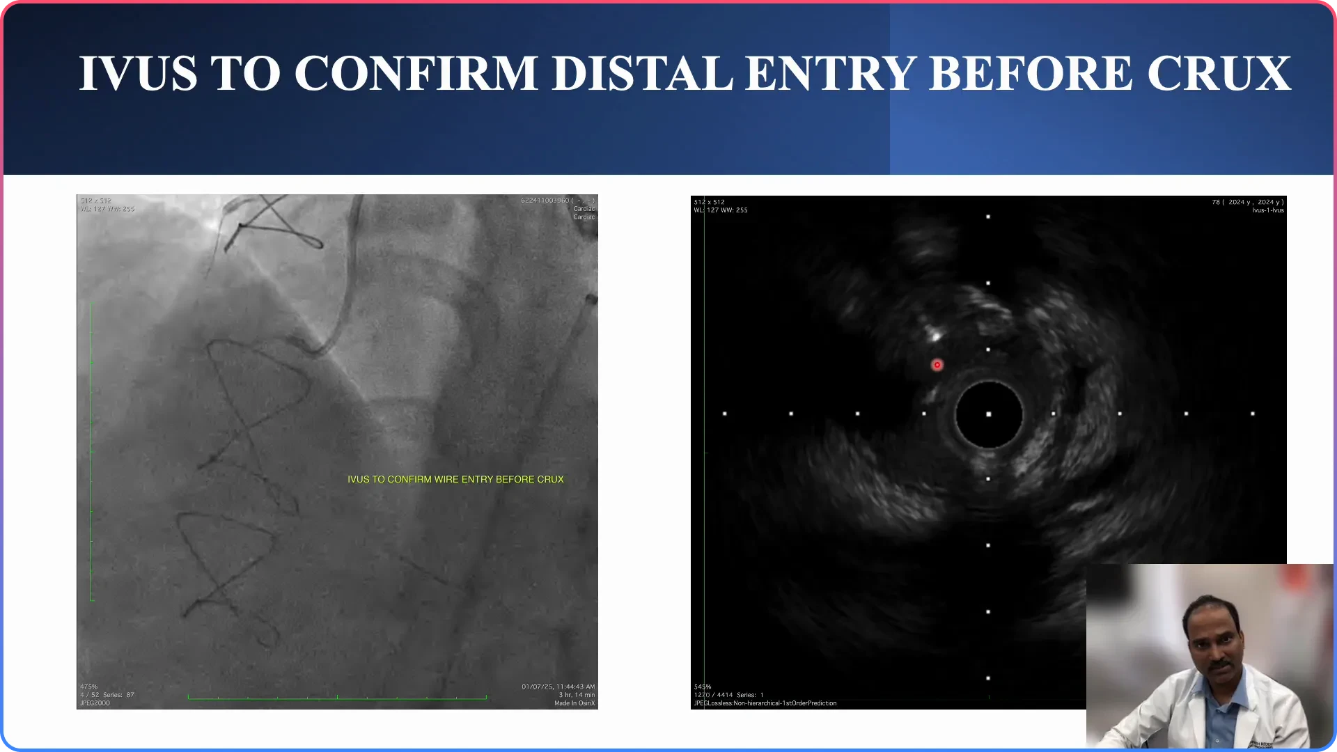 Imaging Confirmation