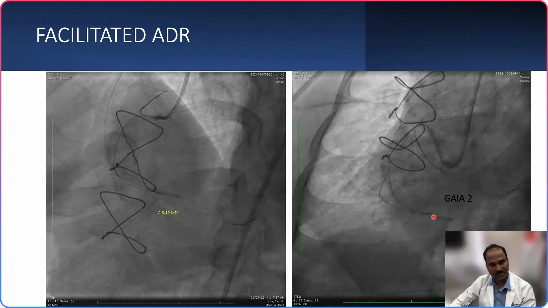 Facilitated ADR