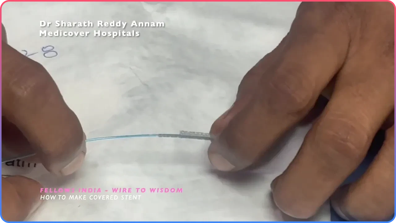 Crimp Stent