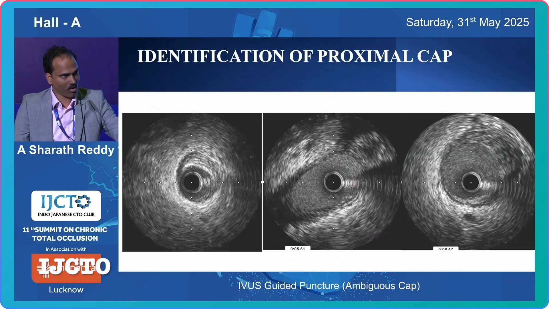 Step 1 Identification
