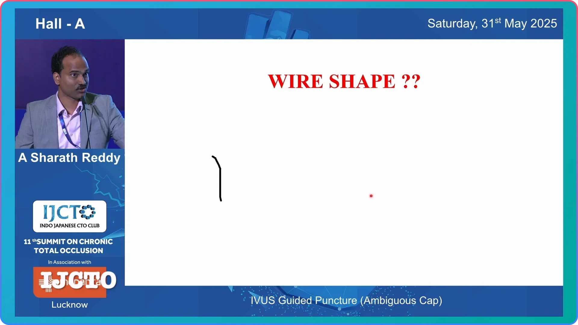Optimizing Wire Shape