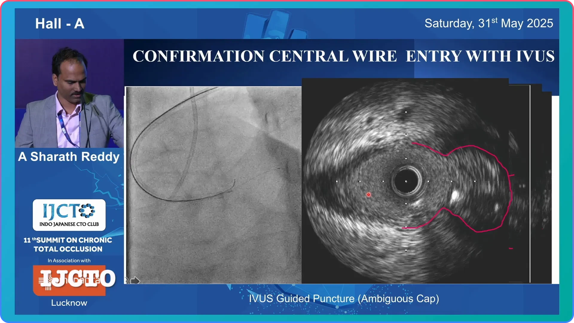 Confirming Wire Position