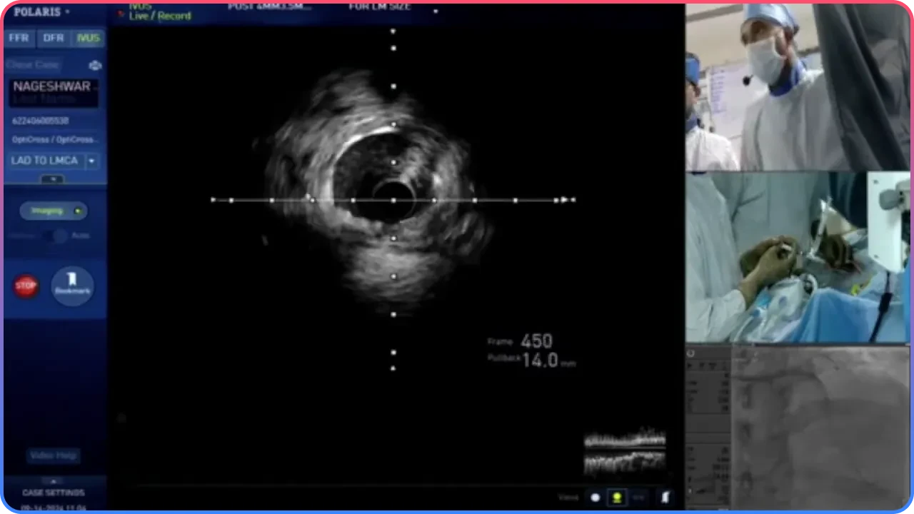 Post-Procedure Imaging and Results