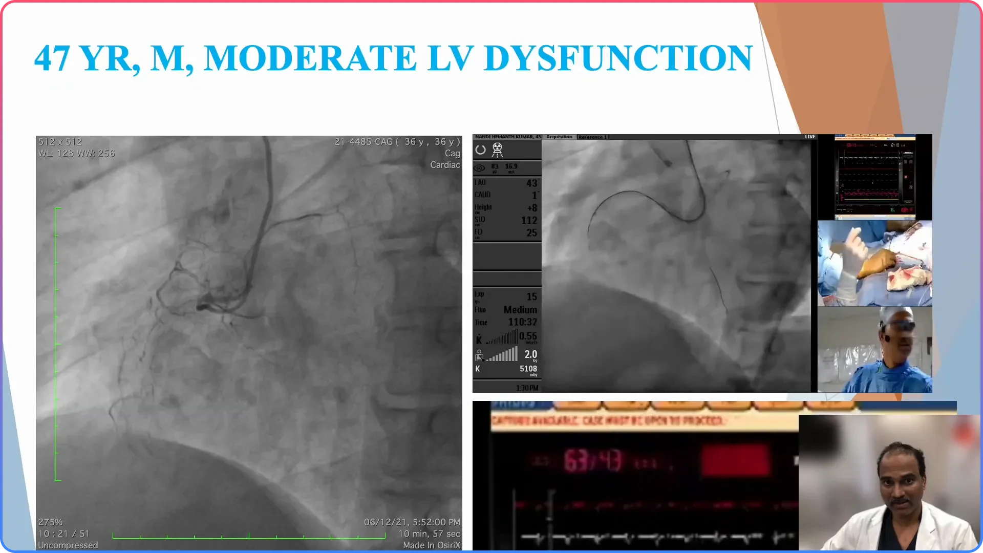 Challenges with Hemodynamic Consequences
