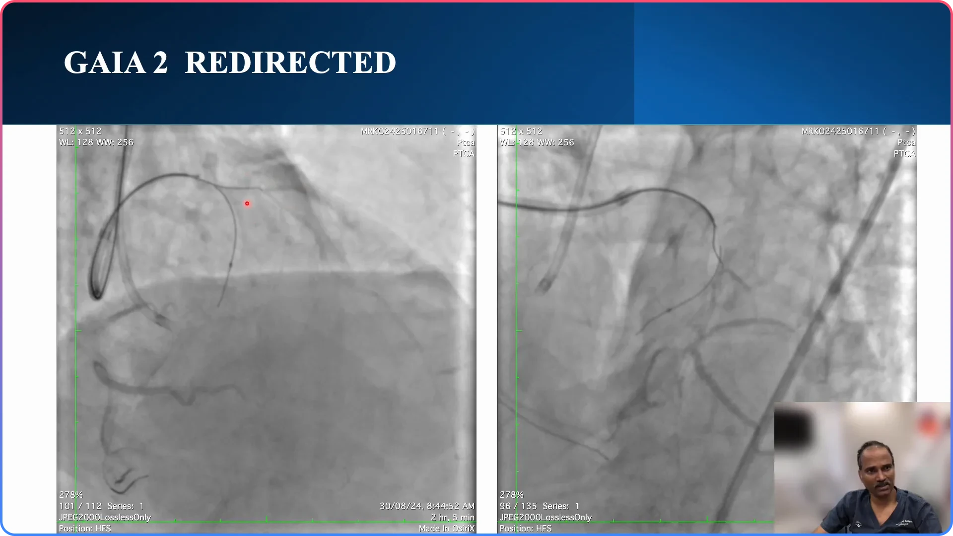 Wire Positioning and Adjustments