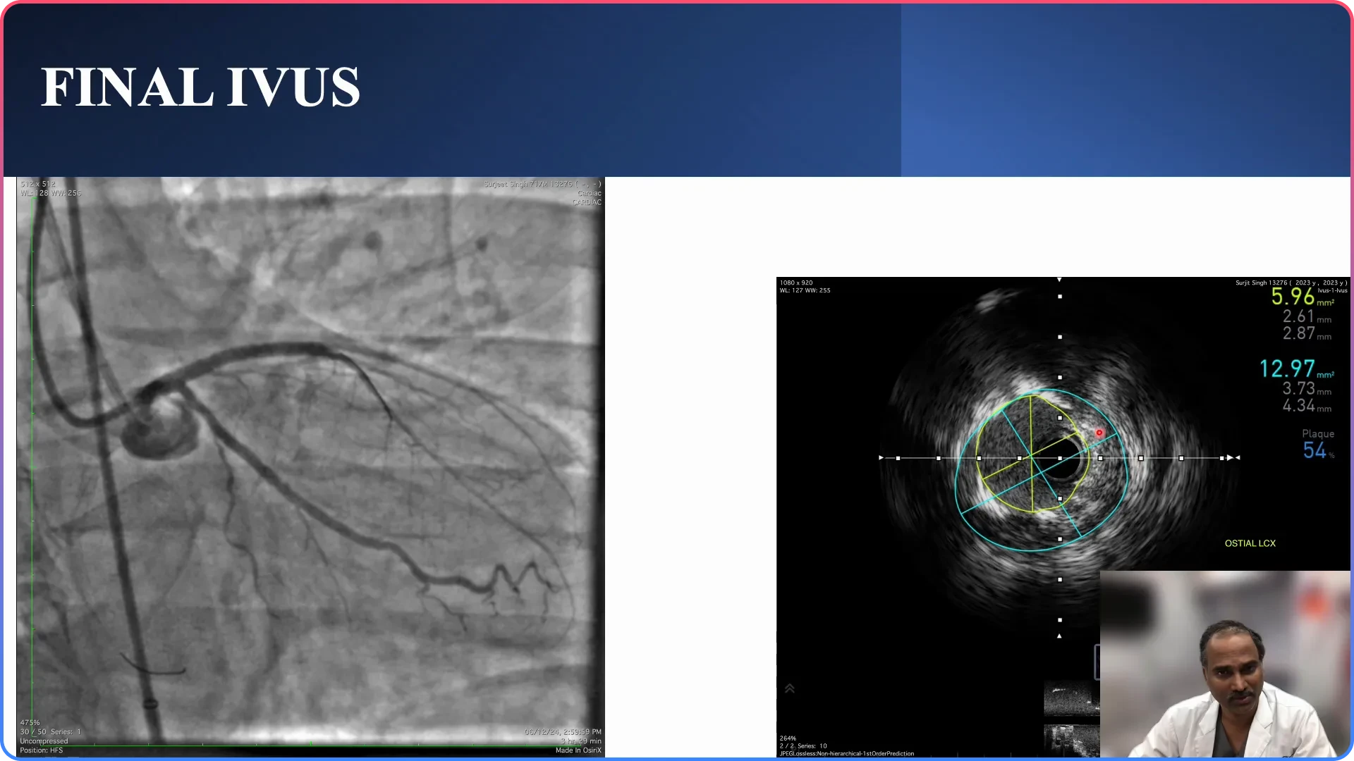 Final Angiographic Results