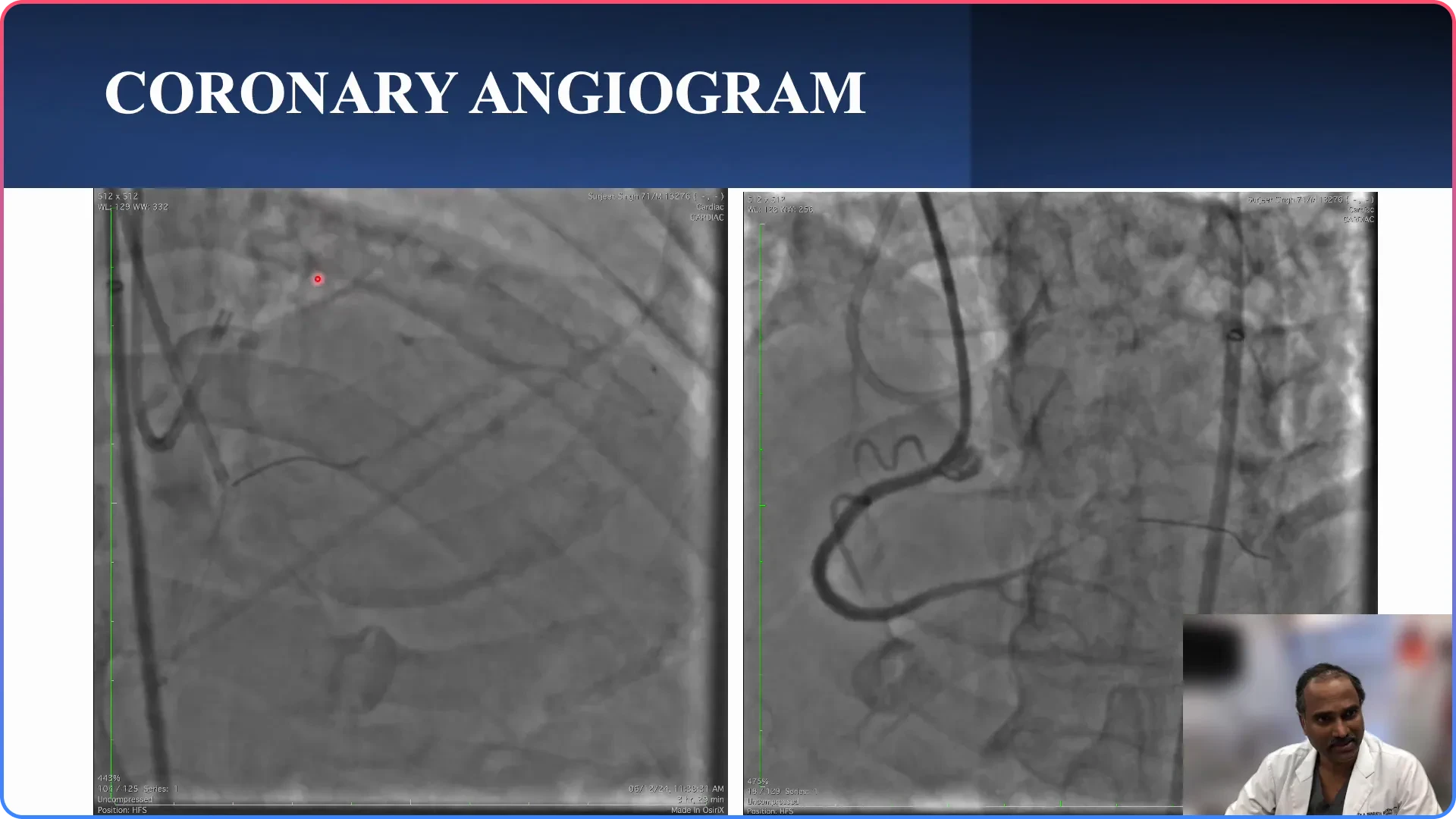 Dual Angiography Overview
