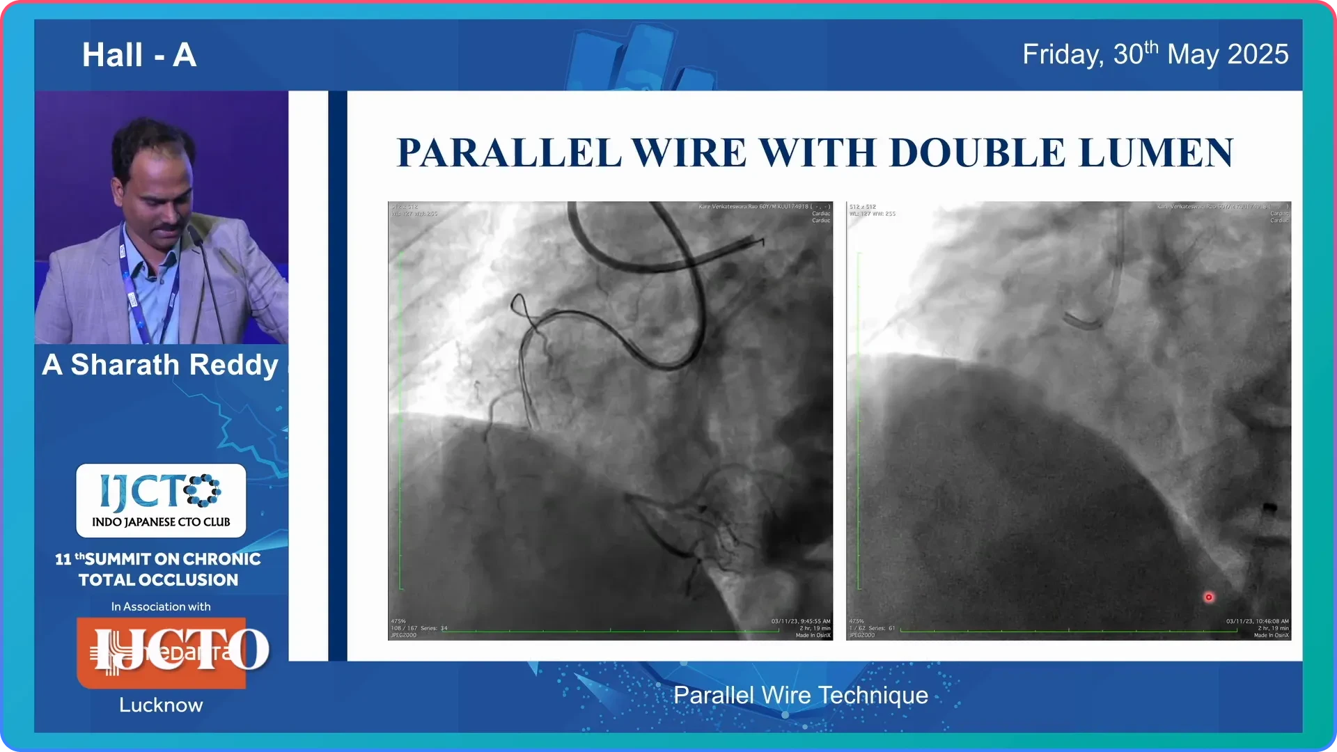 Wire Selection