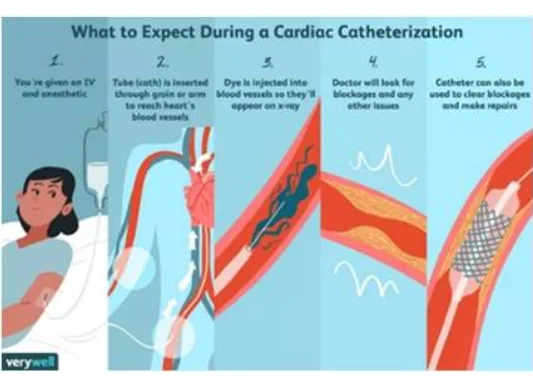 Cardiac Catheterization / Angiogram