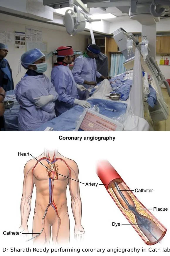 Before and During the Procedure