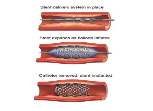 service Image