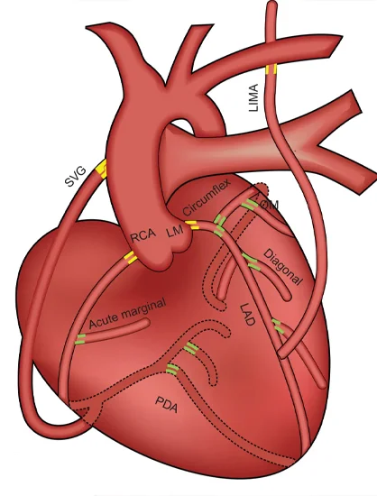 Diagnosis and Treatment