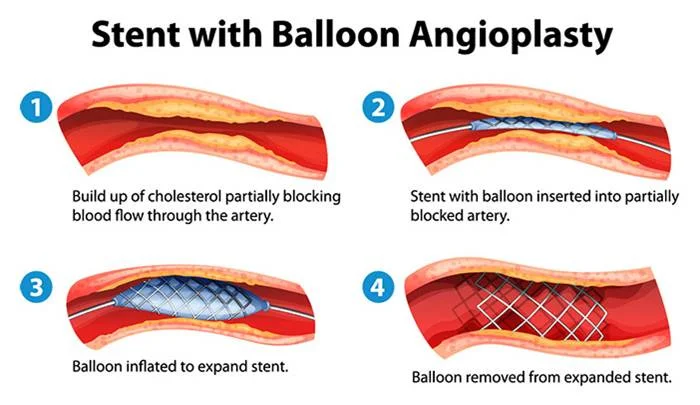 Diagnosis and Treatment