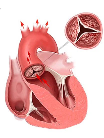 During the Procedure
