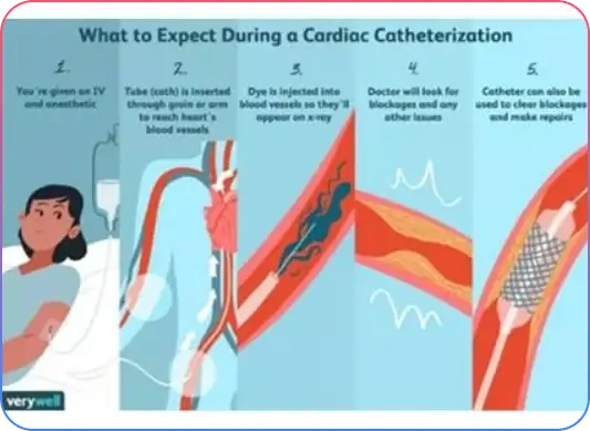 Pre Procedural Imaging