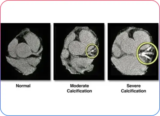 Pre Procedural Imaging