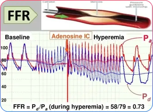 Pre Procedural Imaging