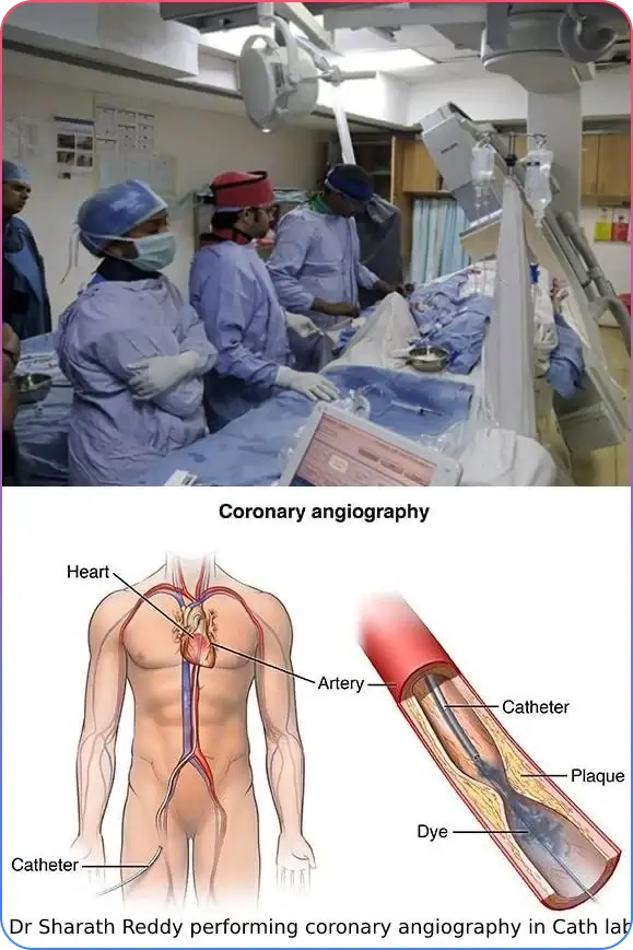 Coronary Angiogram Procedure