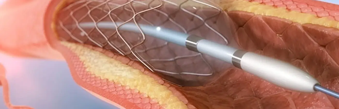 Interventional Therapies