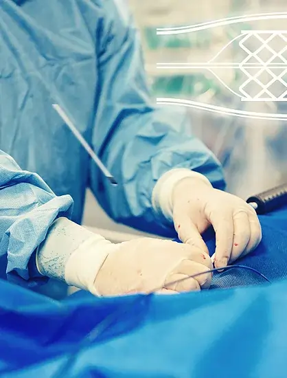 During PCI Procedure