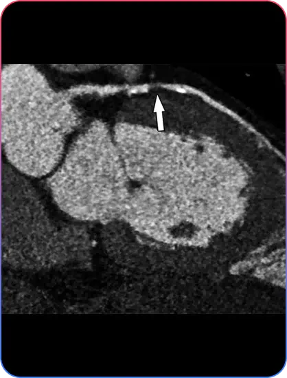 Pre Procedural Imaging