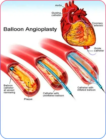 Pre Procedural Imaging