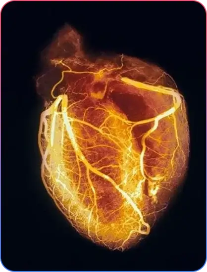 Pre Procedural Imaging