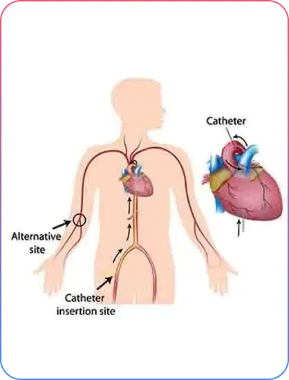 Pre Procedural Imaging