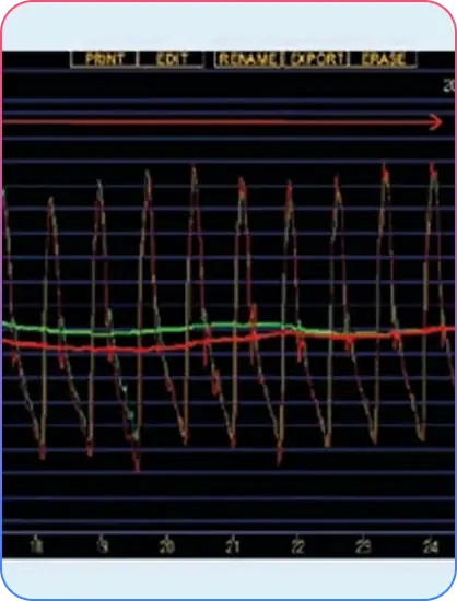 Aorto-Ostial Lesions