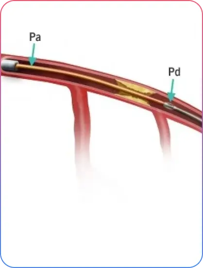 Pre Procedural Imaging