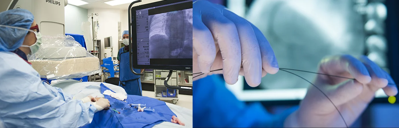 Interventional Therapies