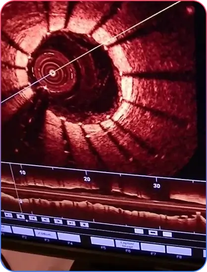 Pre Procedural Imaging