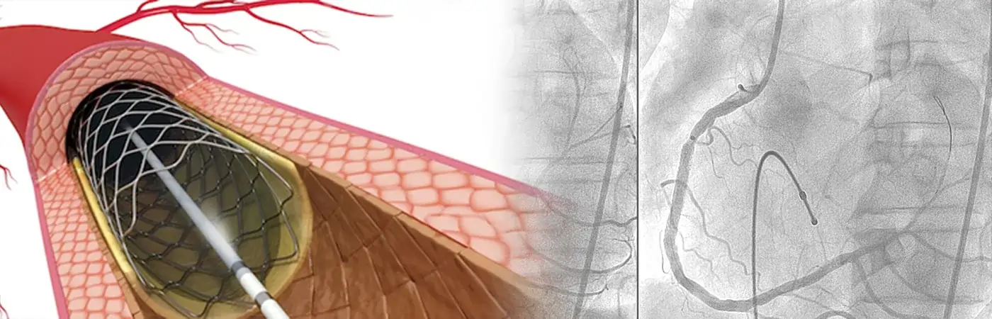 Interventional Therapies