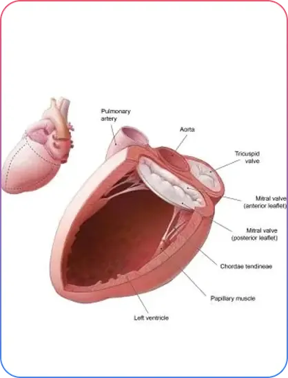 Pre Procedural Imaging