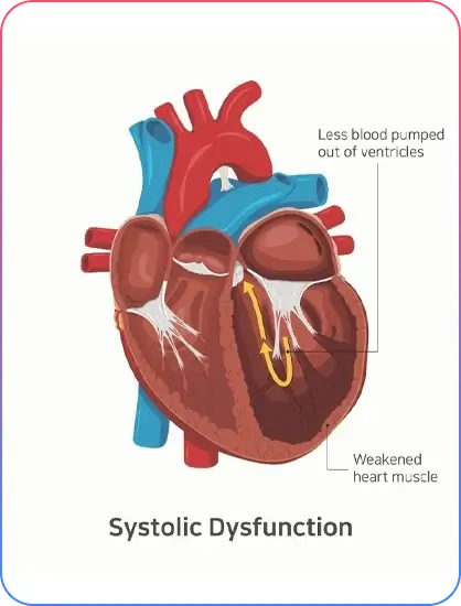 Heart Valve Surgery