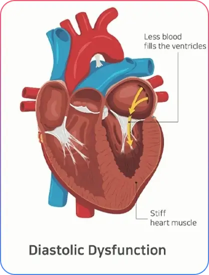Heart Pacemaker