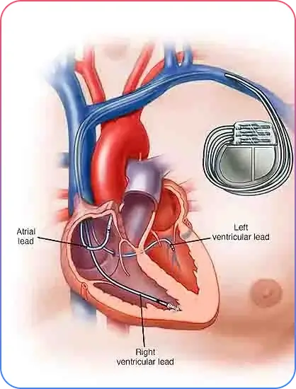 Pre Procedural Imaging